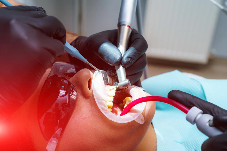 Teeth Whitening treatment in Ahmedabad