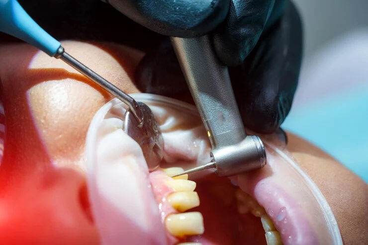 Flap Surgery Treatment in Ahmedabad