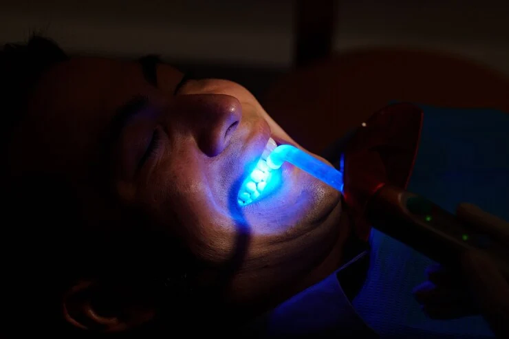 laser dentistry treatment in Ahmedabad