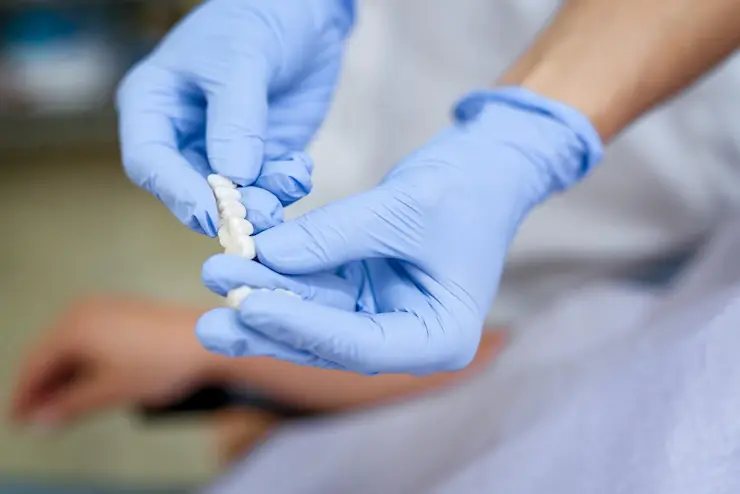 porcelain veneer Treatment in Ahmedabad